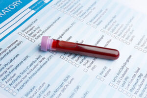 Blood test report
